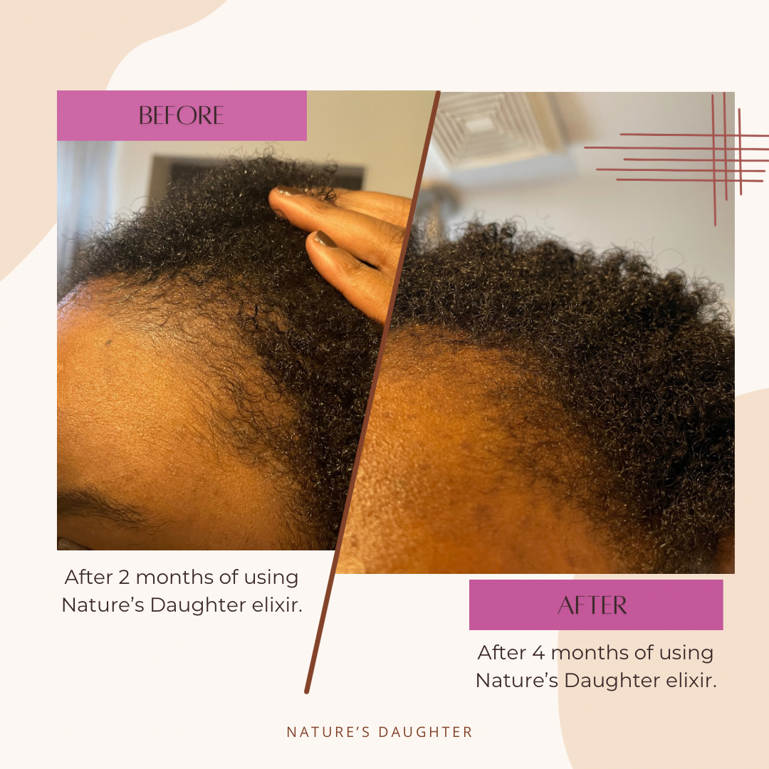 Nature's Daughter Ayurvedic Hair Growth Oil