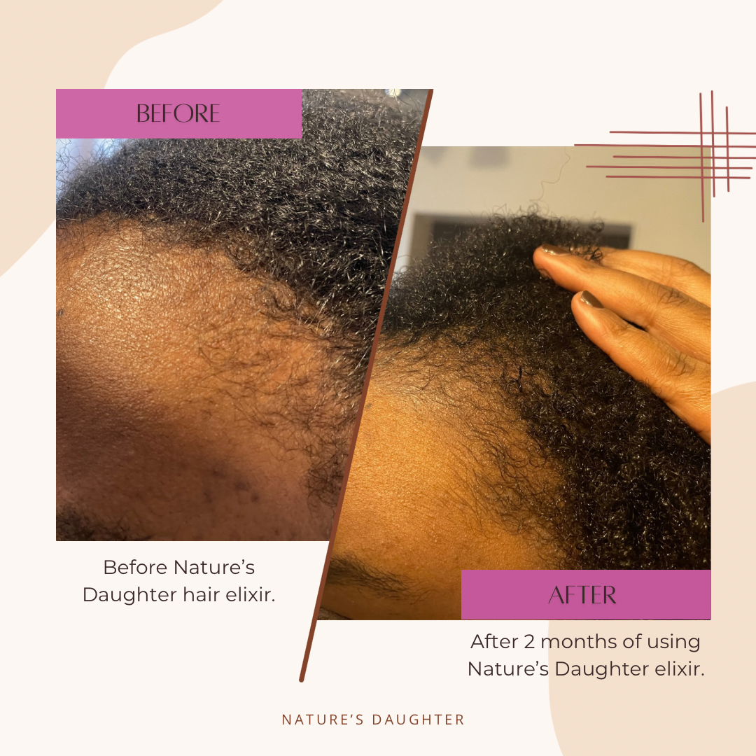 Nature's Daughter Ayurvedic Hair Growth Oil